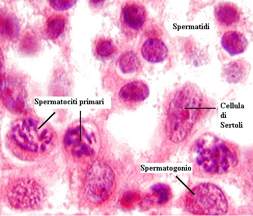 spermatogonio