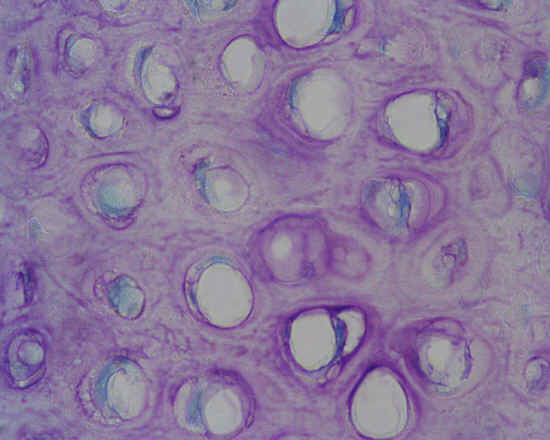cartilagine