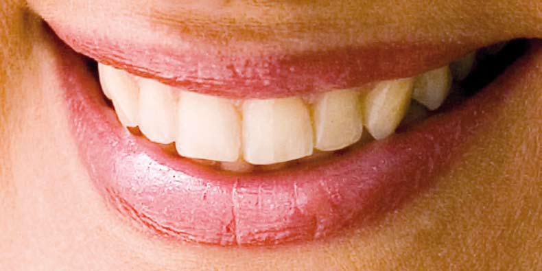 sorriso