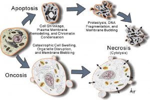 oncosi-necrosi