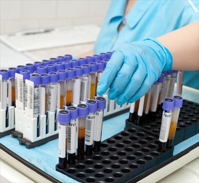 ves-esami-laboratorio