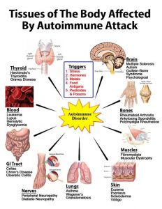 Malattie Infiammatorie da Disordine Immunologico