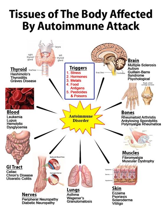 Malattie Infiammatorie da Disordine Immunologico