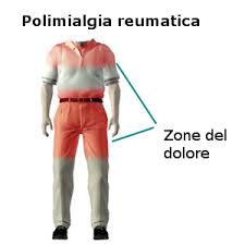 polimialgia-reumatica