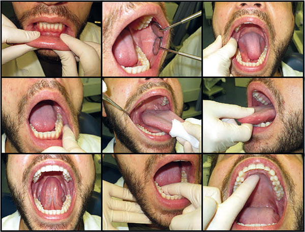 odontogena