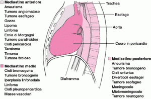 mediastino1