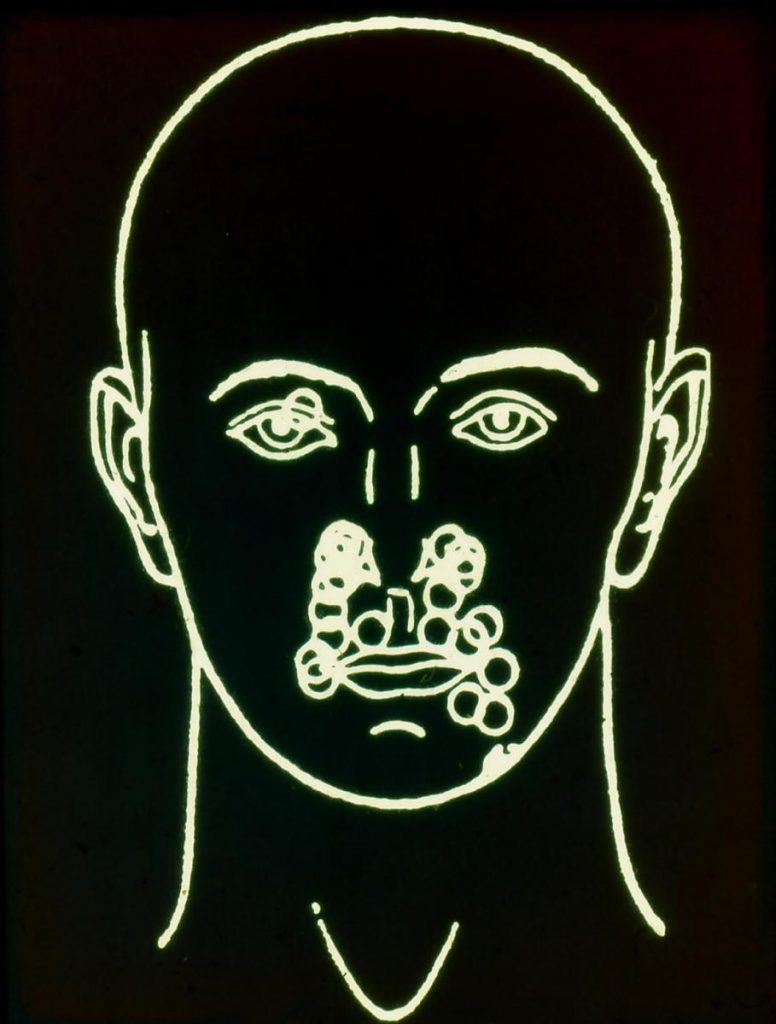 trigemino